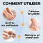 🌸Fête des mères vente chaude 50% RÉDUCTION 🌸Extracteur de callosités électrique pour les pieds