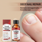 💅 ACHETEZ 2, OFFERT 1 ! ✨ Essence Réparatrice pour Ongles Abîmés – Renforcement Rapid, Hydratation Profonde & Résultats Durables 💎